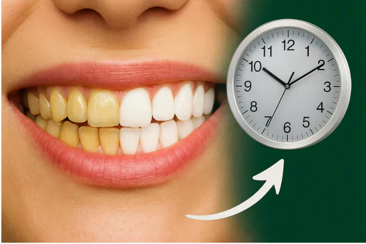 Mulut dengan gigi separuh kuning dan separuh putih, dan jam untuk melambangkan tempoh pemutihan gigi.