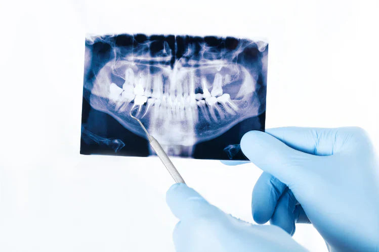 Seseorang yang memegang x-ray gigi yang sesak.
