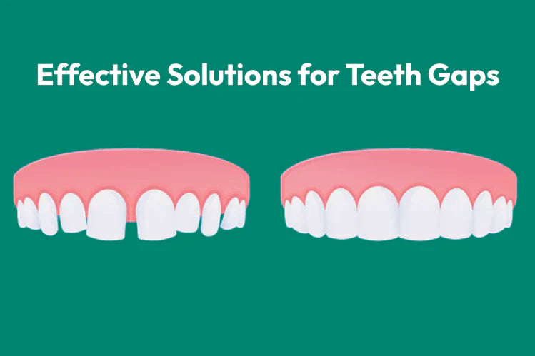 Perbandingan sebelah menyebelah gigi celah dan gigi normal