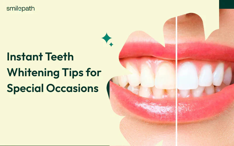 Imej sebelum dan selepas gigi yang diputihkan.