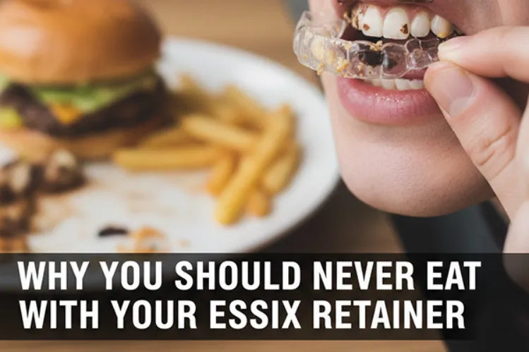 Makan dengan retainer