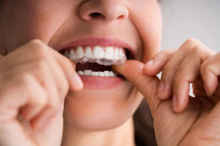 Seorang gadis memakai penjajar gigi.