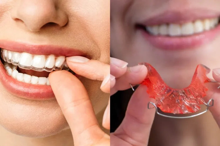 Imej menunjukkan perbezaan antara Hawley dan Clear Retainers