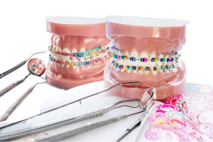 Model pergigian dengan pendakap berwarna