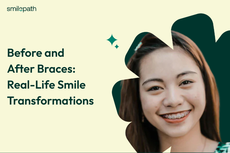 Pendakap Sebelum dan Selepas: Transformasi Senyuman Kehidupan Sebenar